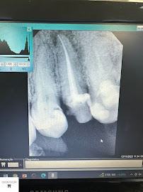 Clínica Odontológica Odontocor - Dentista Centro Rj | Especialista em Tratamento de Canal