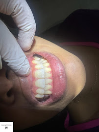 Clínica Odontológica Odontocor - Dentista Centro Rj | Especialista em Tratamento de Canal
