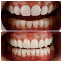 New Smile Dentists คลินิกทันตกรรมนิวสมายล์ Dental Clinic in Patong Phuket