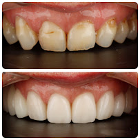 New Smile Dentists คลินิกทันตกรรมนิวสมายล์ Dental Clinic in Patong Phuket