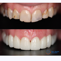 New Smile Dentists คลินิกทันตกรรมนิวสมายล์ Dental Clinic in Patong Phuket