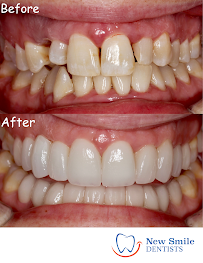 New Smile Dentists คลินิกทันตกรรมนิวสมายล์ Dental Clinic in Patong Phuket