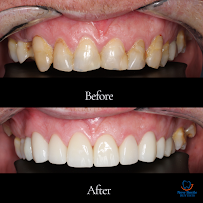 New Smile Dentists คลินิกทันตกรรมนิวสมายล์ Dental Clinic in Patong Phuket
