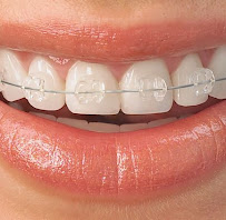 Dental World Chiang Mai คลินิกทำฟันเชียงใหม่