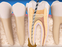 Dental World Chiang Mai คลินิกทำฟันเชียงใหม่