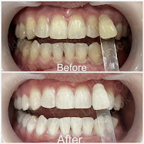 Dental Point Clinic Chiang mai ทำฟัน จัดฟัน เชียงใหม่
