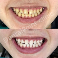 Dental Point Clinic Chiang mai ทำฟัน จัดฟัน เชียงใหม่