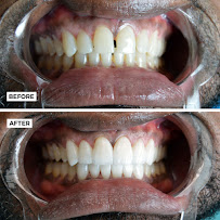 Good Samaritan Dental Smile Design