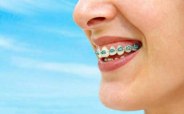 คลินิกทันตกรรมทีสมาย์ เชียงใหม่ : T Smile Dental Clinic Chiang Mai - dental clinic in Chiang Mai, Thailand