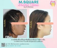 ทำฟัน จัดฟัน เชียงใหม่ M.Square Dental Care - Chiang Mai Dental Esthetic Center
