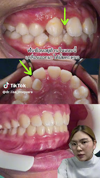 ทำฟัน จัดฟัน เชียงใหม่ M.Square Dental Care - Chiang Mai Dental Esthetic Center