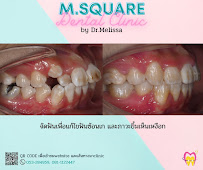 ทำฟัน จัดฟัน เชียงใหม่ M.Square Dental Care - Chiang Mai Dental Esthetic Center
