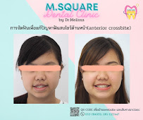 ทำฟัน จัดฟัน เชียงใหม่ M.Square Dental Care - Chiang Mai Dental Esthetic Center