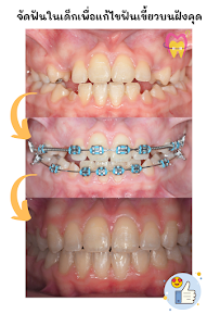 ทำฟัน จัดฟัน เชียงใหม่ M.Square Dental Care - Chiang Mai Dental Esthetic Center