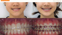 ทำฟัน จัดฟัน เชียงใหม่ M.square Dental Clinic in Chiang Mai