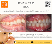 ทำฟัน จัดฟัน เชียงใหม่ M.Square Dental Care - Chiang Mai Dental Esthetic Center