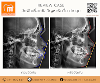 ทำฟัน จัดฟัน เชียงใหม่ M.Square Dental Care - Chiang Mai Dental Esthetic Center