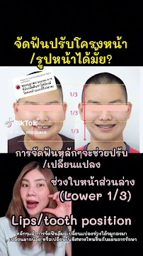 ทำฟัน จัดฟัน เชียงใหม่ M.Square Dental Care - Chiang Mai Dental Esthetic Center