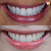 ทำฟัน จัดฟัน เชียงใหม่ M.Square Dental Care - Chiang Mai Dental Esthetic Center