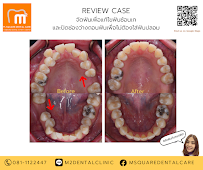 ทำฟัน จัดฟัน เชียงใหม่ M.Square Dental Care - Chiang Mai Dental Esthetic Center