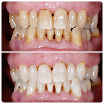 Wellsmiles dental clinic คลินิกทันตกรรมเวลสไมล์ เชียงใหม่