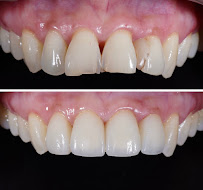 Wellsmiles dental clinic คลินิกทันตกรรมเวลสไมล์ เชียงใหม่