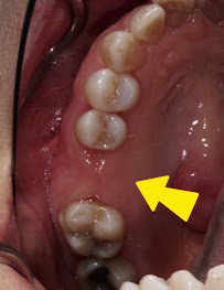MG Implant Center