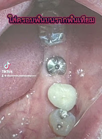 MG Implant Center