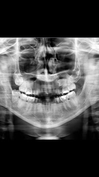 MG Implant Center