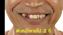MG Implant Center
