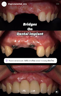 MG Implant Center