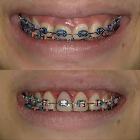 MG Implant Center
