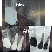 Dra. Erlyn Pulvet - Odontología estética, rehabilitación y diseño de sonrisa en Tijuana