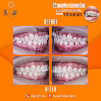 Dentist Smile Clinic คลินิกทันตกรรมเดนทิสท์ สไมล์