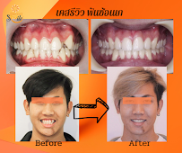 Dentist Smile Clinic คลินิกทันตกรรมเดนทิสท์ สไมล์