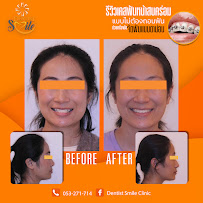 Dentist Smile Clinic คลินิกทันตกรรมเดนทิสท์ สไมล์
