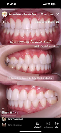Dentist Smile Clinic คลินิกทันตกรรมเดนทิสท์ สไมล์