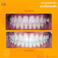 Dentist Smile Clinic คลินิกทันตกรรมเดนทิสท์ สไมล์