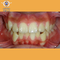 OrthoSmile Dental Clinic : Dentist Dental Clinic Pattaya ทำฟัน จัดฟัน จัดฟันแบบใส Invisalign พัทยา