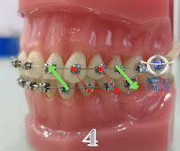 OrthoSmile Dental Clinic : Dentist Dental Clinic Pattaya ทำฟัน จัดฟัน จัดฟันแบบใส Invisalign พัทยา