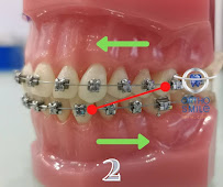 OrthoSmile Dental Clinic : Dentist Dental Clinic Pattaya ทำฟัน จัดฟัน จัดฟันแบบใส Invisalign พัทยา