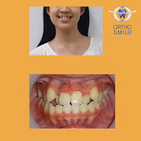 OrthoSmile Dental Clinic : Dentist Dental Clinic Pattaya ทำฟัน จัดฟัน จัดฟันแบบใส Invisalign พัทยา