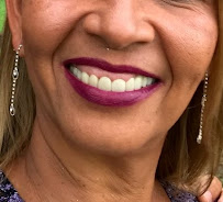 Dental Implants Costa Rica - Dr. Jairo Vargas Clinic