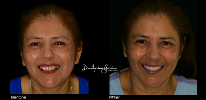 Smile Studio