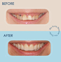Smile Studio