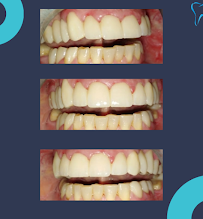 Ordinacija dentalne medicine Aleksandar Kovačević, dr.med.dent.