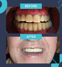 Ordinacija dentalne medicine Aleksandar Kovačević, dr.med.dent.