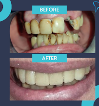 Ordinacija dentalne medicine Aleksandar Kovačević, dr.med.dent.