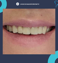 Ordinacija dentalne medicine Aleksandar Kovačević, dr.med.dent.