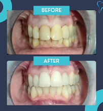 Ordinacija dentalne medicine Aleksandar Kovačević, dr.med.dent.